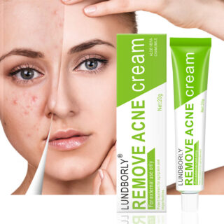 OEM Fast Effective Repair Pimple Scar Anti Spots Removal Acne Gel Smooth Skin Shrink Pores Salicylic Acid Acne Face Cream